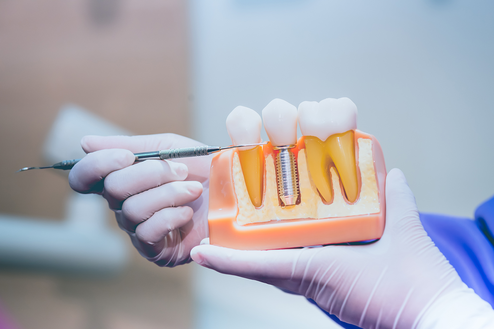 Value Dental Center | Implant Dentistry, All-on-4 reg  and Dental Bridges